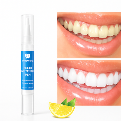 SmileWorks™ Długopis Wybielający